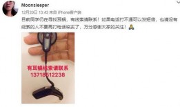 耳蜗在线观看,揭秘听觉世界的奥秘之旅